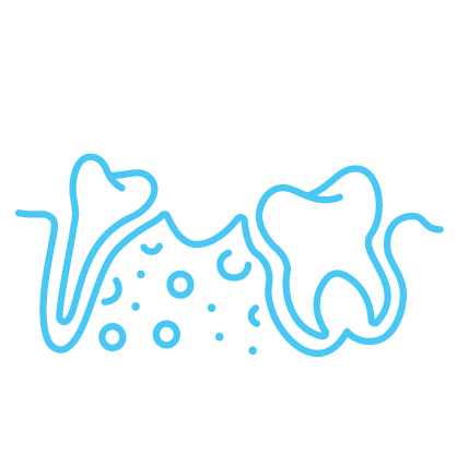 bone grafting